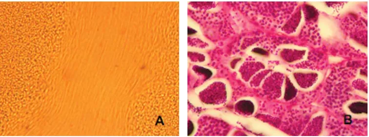 Gambar 8. Motilitas sperma hasil kanulasi (A) dan testis matang histologis (B)Figure 8.Motilities of the stripped sperm (A) and histological slide of mature testis (B)