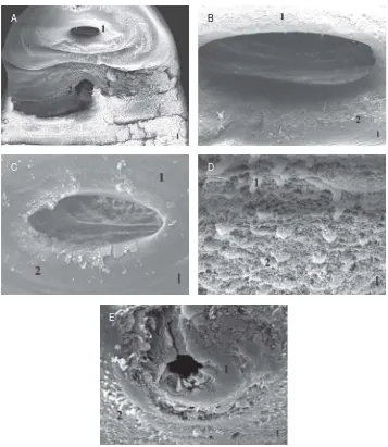Gambar 2. Permukaan tubuh Clinostomum complanatum pada ikan betok (Anabas testudineus)