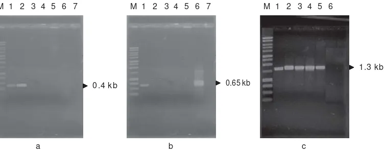 Gambar 6. Hasil amplifikasi, (a) gen nap, M:marker; 1. kontrol positif; 2. hasil amplifikasi kontrol