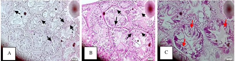 Gambar 5.Gambaran histopatologi hepatopankreas udang windu yang ditantang dengan WSSV