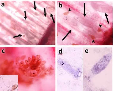 Gambar 2.Infeksi parasit insang pada lamella insang kerapu hibrida “cantik”. a). Parasit insang (tanda panah)terlihat di antara lamella sekunder dari insang kerapu hibrida “cantik”