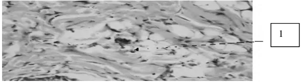 Gambar 1. Histopatologi kulit tikus kelompok kontrol; Pewarnaan H-E; Ket : 1.Epitelisasiyang kurang; 2