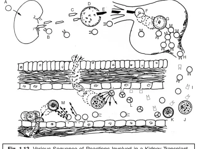 Fig. 1.13. Various Sequence of Reactions Involved in a Kidney Transplant.