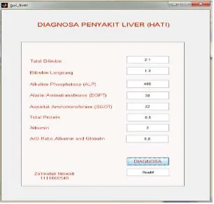Gambar 12. GUI Diagnosa Penyakit Liver (hati) 