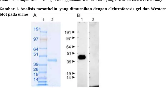 Gambar 2. Mesothelin terlarut terdeteksi dalam darah pasien dengan kanker pankreas 