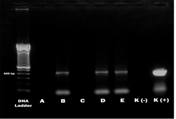 Gambar 1.  Hasil elektroforesis RT-PCR fragmen VP-2 gene virus IBD, teramati pita DNA pada posisi 440 bp