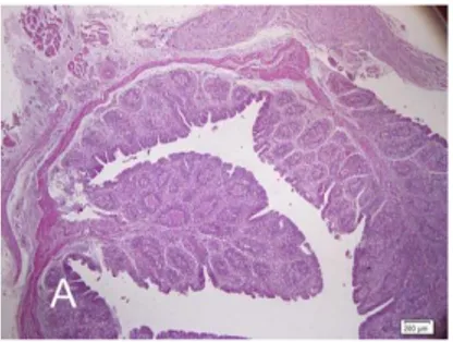 Gambar 2. Perubahan histopatologi organ bursa fabricius 