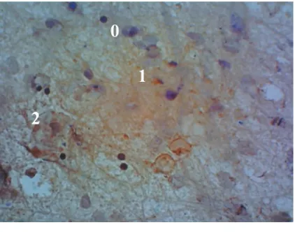 Gambar 5.1   Hasil pengamatan secara imunohistokimiaekspresiHSP 70 makrofag peritoneum sediaan  hewan   yang   mendapat paparan ME selama 2 minggu dan diinfeksi Toxoplasma gondii dengan pembesaran 400x