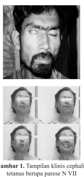 Gambar 1. Tampilan klinis cephalic 