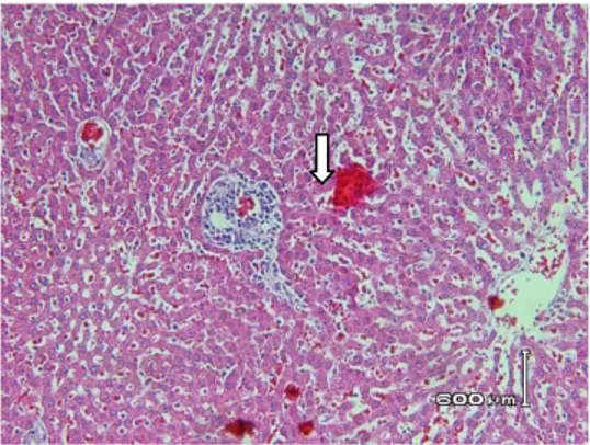 Gambar  3.  Gambaran  histopatologis  kelompok  II  (DMBA)  yang  mengalami  limfoblastik 