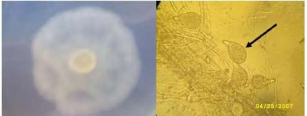 Gambar 2. Koloni jamur P. capsici yang ditemukan. A. Koloni dengan pola bintang.  B. pengamatan sporangium di bawah mikroskop (anak panah)