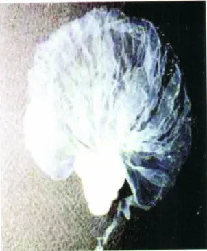 Gambar  1.  Spermatopora  udang  windu  (P  monodon)