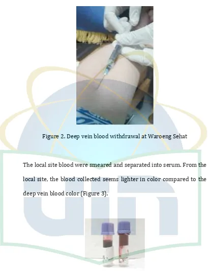 Figure 2. Deep vein blood withdrawal at Waroeng Sehat 