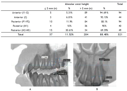 Table 1. Percentage of mesial and distal tooth surface with the alveolar bone crest height of ≤2mm and >2mm 