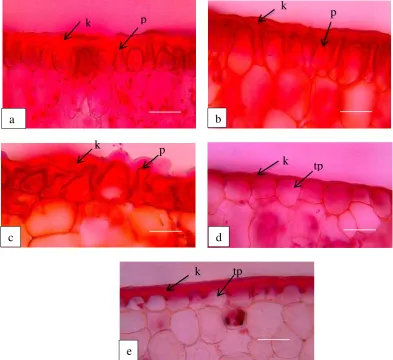 Gambar 10. Epidermis atas daun 5 spesies Sansevieria. (a) S. sufruticosa, (b) S. samurai dwarf, (c) S