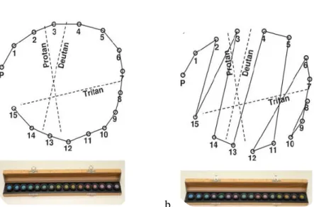 Gambar 10. Gambaran hasil normal (a) dan deutranopia (b) pada pemeriksaan FMD-15              Dikutip dari: Kremers J