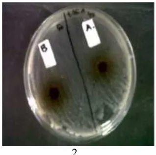 Gambar 4.1 Hasil uji aktivitas antibakteri air daun Sawo terhadap bakteri Escherichia 