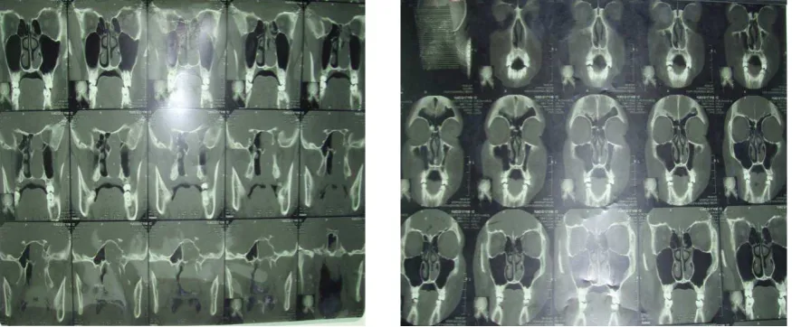 Figure 1 & 2. 