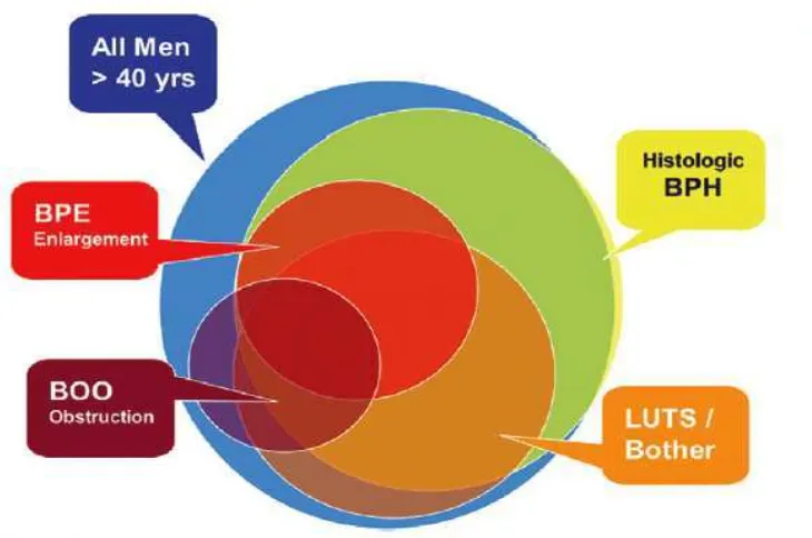 Gambar 2.3. Hubungan Antara BPH, LUTS, Pembesaran Prostat , dan Obstruksi Kandung Kemih  Pada Pria Berusia Lebih Dari 40 Tahun (modifikasi dari Roehrborn, 2012)