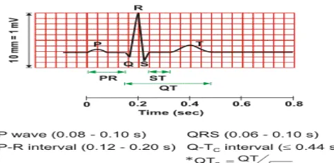Gambar 2. EKG Normal 