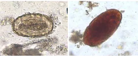 Gambar 2.2 Telur Ascaris lumbricoides14