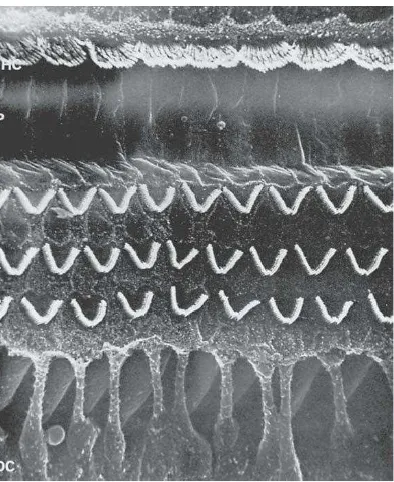 Gambar 2.5  Sel Rambut Luar dan Dalam Dilihat dengan  Mikroskop Elektron  
