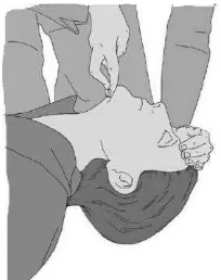 Gambar 2.3. Head-tilt, chin-lift maneuver (sumber: European  Resuscitation 