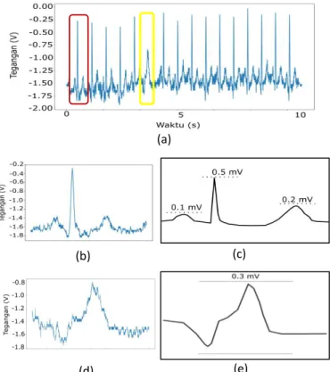 Gambar 13. Perbandingan sinyal lead 1, (a) Sinyal output lead 1 dari oscilloscope yang ditampilkan oleh software python, (b) Potongan sinyal yang bearasal dari
