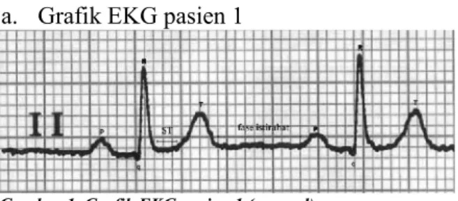 Gambar 1. Grafik EKG pasien 1 (normal)