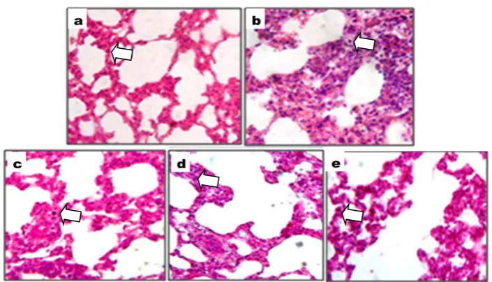 Gambar 1. Gambaran histopatologi jaringan paru tikus dengan pewarnaan HE, perbesaran 400x