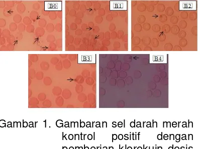 Gambar 1. Gambaran sel darah merah kontrol positif dengan pemberian klorokuin dosis 5,71 mg/Kg BB pada hari ke-0 sampai ke-4 