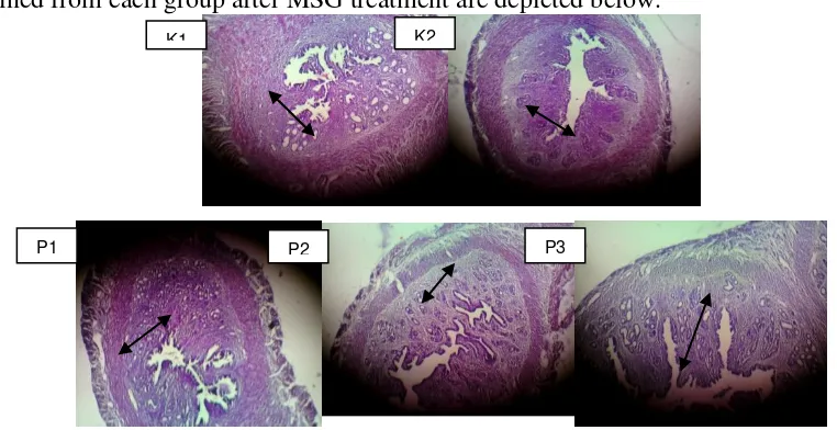 Table 1.The comparison among the effects of curcuma rhizome extract treatment with different doses to observe the endometrial thickness of mice orally treated with MSG