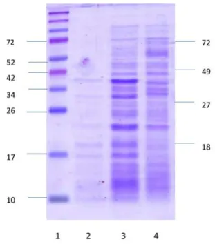 Figure  1. Profile of Pili and Omp of  flexneriS.  flexneri (1: marker protein; 2 : pili slices 1 of s