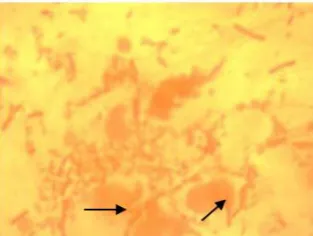 Figure 3 . Attachment of S. flexneri to mice enterocytes 