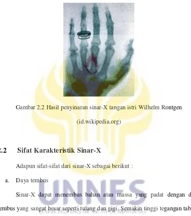 Gambar 2.2 Hasil penyinaran sinar-X tangan istri Wilhelm Rontgen 