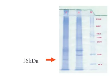Gambar 1. Hasil amplifikasi DNA daun jeruk dengan PCRKeterangan:  M = Marker, kolom 1 adalah daun sehat dan kolom 2 adalah daun sakit