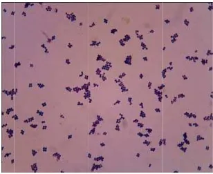 Gambar 1. HasGsil pengecatann gram bakterri Staphylococccus aureus