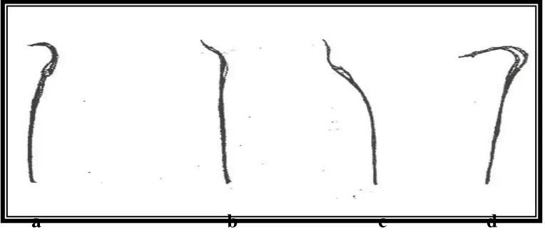 Gambar 2.4   Bentuk-bentuk sperma abnormal pada tikus. a. bentuk sperma      normal; b.sperma abnormal dengan bentuk kepala seperti pisang; c