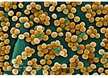 Gambar 2. Staphylococcus aureus (Kurniawan, 2012) 