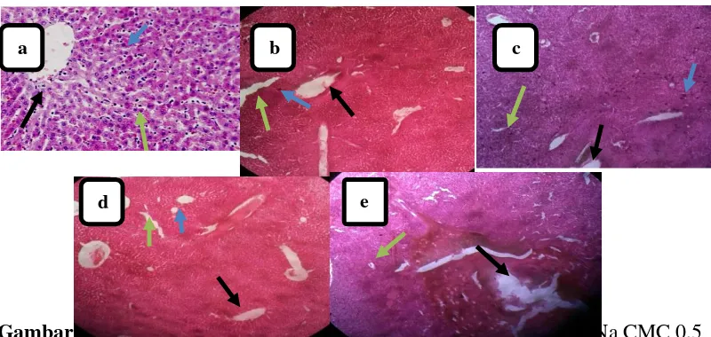 Gambar 1. Gambaran histopatologi hepar mencit yang diberikan: (a) Na CMC 0,5 