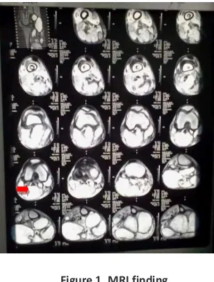 Figure 1. MRI finding