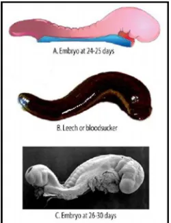 Gambar 1A, menunjukkan pandangan lateral embrio (ukuran 2.5-3.0mm) pada hari 24-25.(Profesor Kathy Sulik, The University of North Carolina)