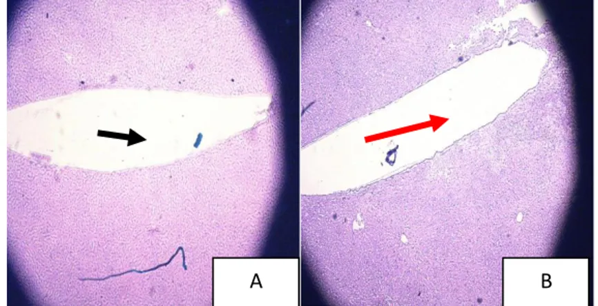 Gambar  1.  Gambaran  pembuluh  darah  vena  cava  dan  vena  porta.  Struktur  histologis 