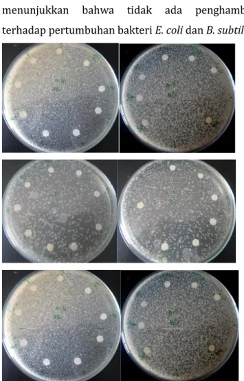 Gambar  4.5  hasil  uji  aktivitas  antibakteri  metode  disk 