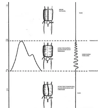 Gambar 10. Bunyi sistolik dan diastolik   