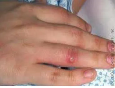 Gambar 4. Gangguan kulit karena alergi 