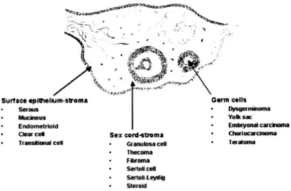 Gambar 1. Asal dari tiga tipe utama tumor ovarium55 