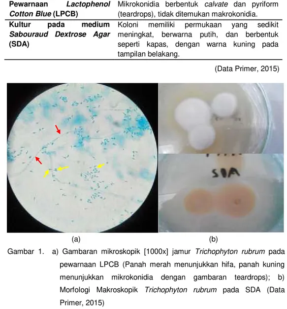 Tabel 2. Uji Karakterisasi jamur Trichophyton rubrum  