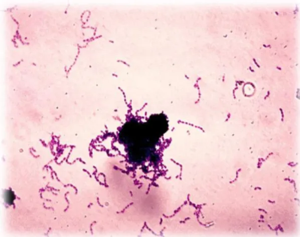 Gambar 2.3 Streptococcus mutans 