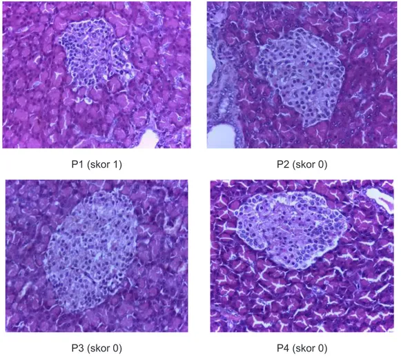 Gambar 5. Gambaran Histopatologi Pankreas Tikus Tiap Kelompok pada Lama Pemberian  35 Hari 